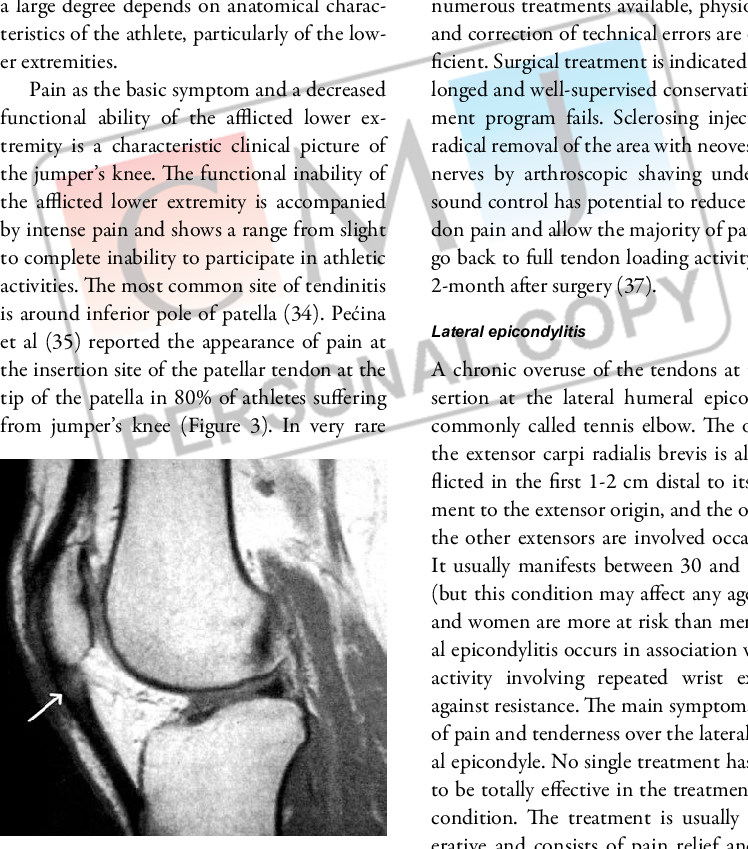 Magnetic Resonance Image Of The Female Volleyball Player - Document (748x849), Png Download