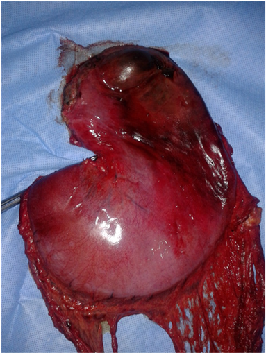 Specimen Of The Resected Stomach - Duck Meat (902x508), Png Download