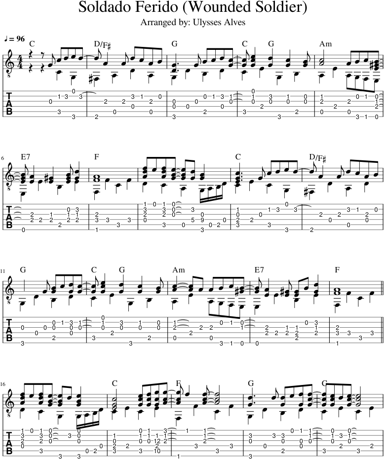 Soldado Ferido Sheet Music 1 Of 2 Pages (850x1100), Png Download