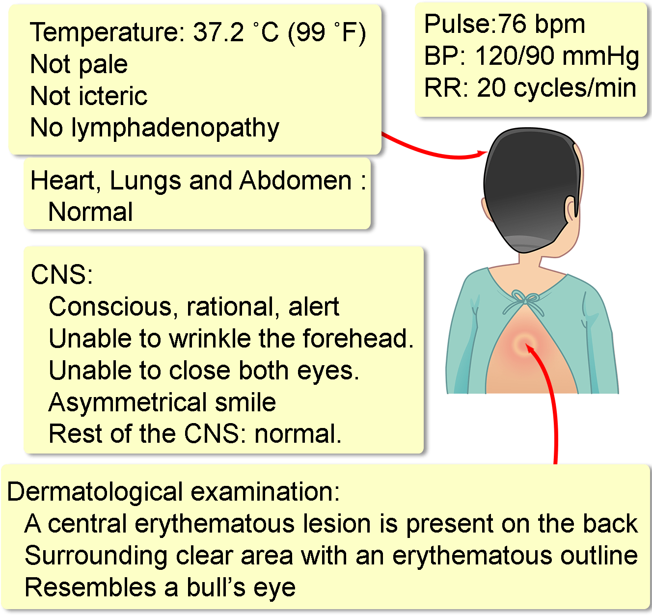 His Medical, Surgical And Family Histories Are Unremarkable (1330x1280), Png Download