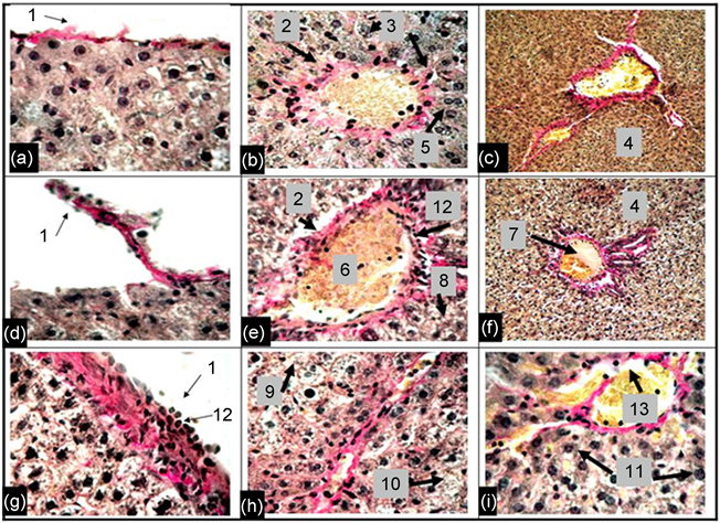 Photomicrographs Liver Preparations Control (c)) And (903x473), Png Download