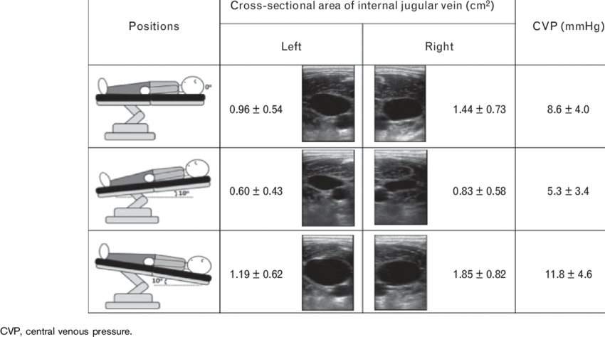 Cross-sectional Area Of Left And Right Internal Jugular (850x474), Png Download