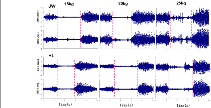 Two Samples Of Bilateral Emg Recordings From Es During (850x376), Png Download