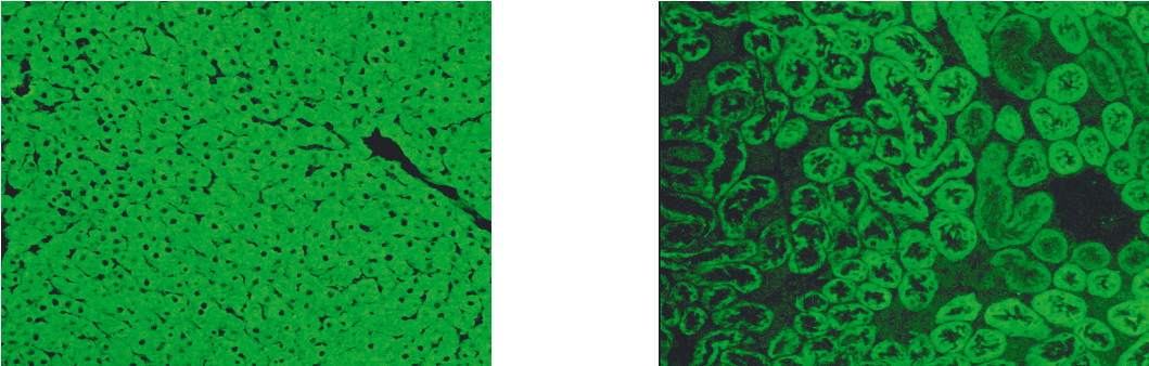 Indirect Immunofluorescence Showing Lkm-1 Autoantibodies (1320x420), Png Download