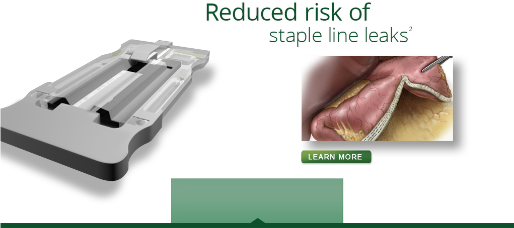 Staple Line Bleeding1* (1020x473), Png Download