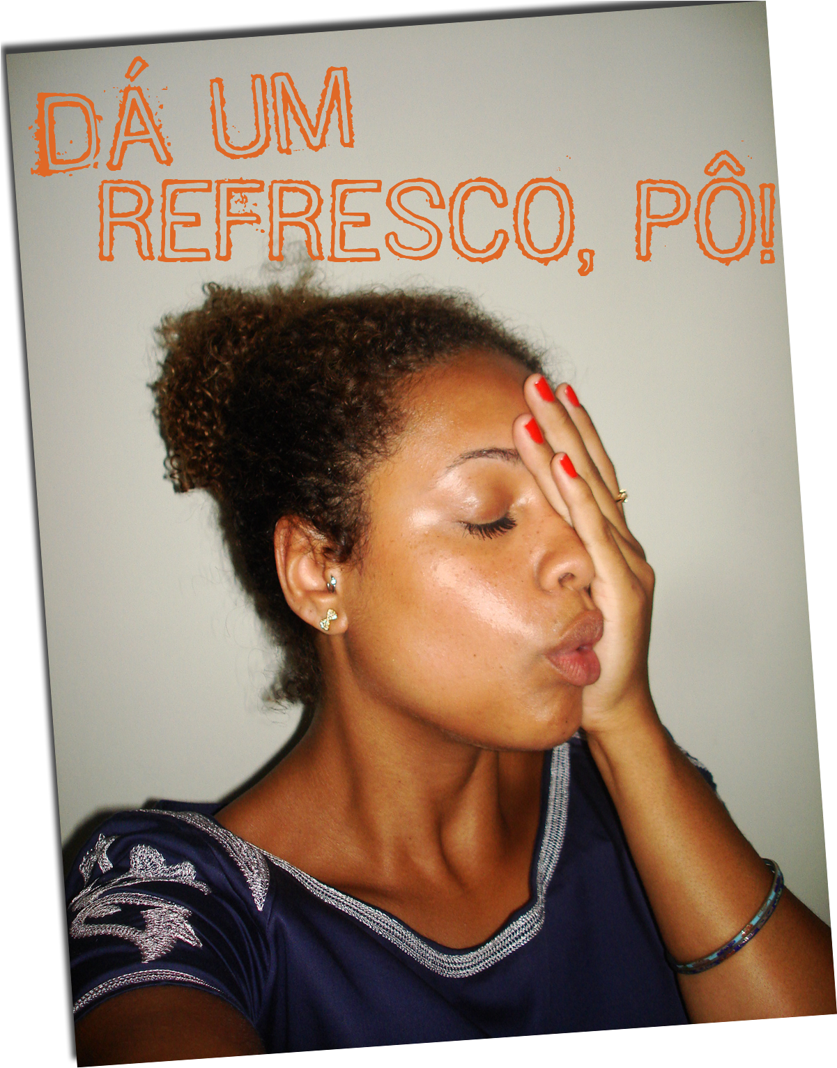 Eu Tenho Aquela Pele Que, Como Diria A Nossa Querida (1200x1600), Png Download