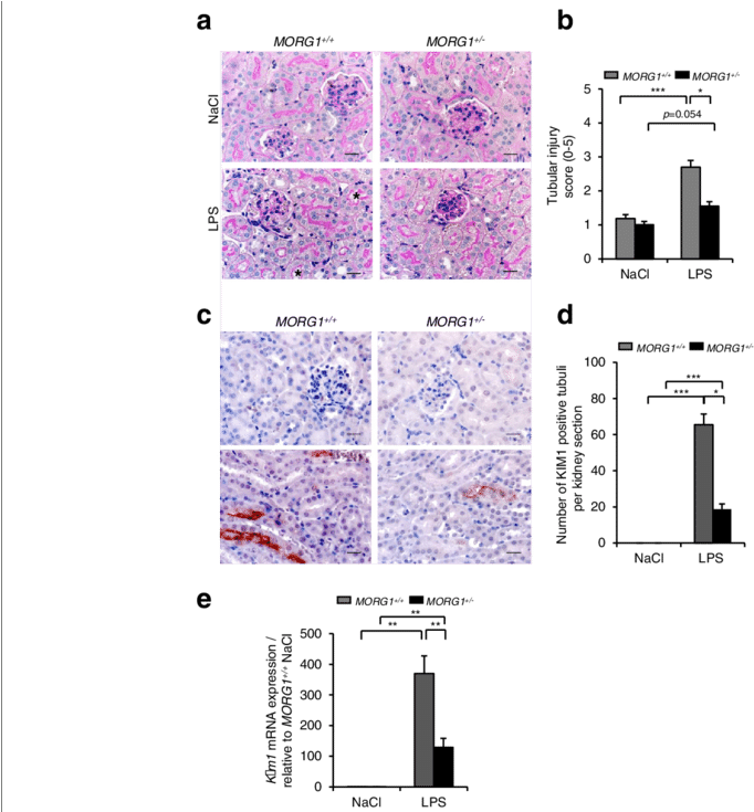 Analysis Of Renal Damage (850x734), Png Download
