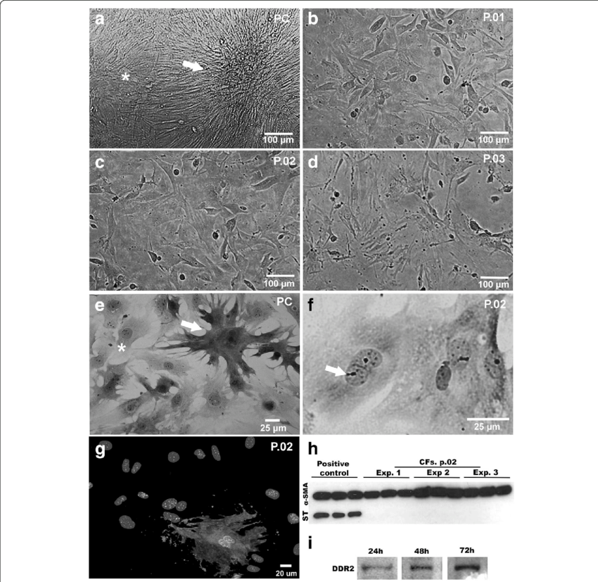 A-f Phase Contrast And Bright Field Microscopy Showing (850x827), Png Download