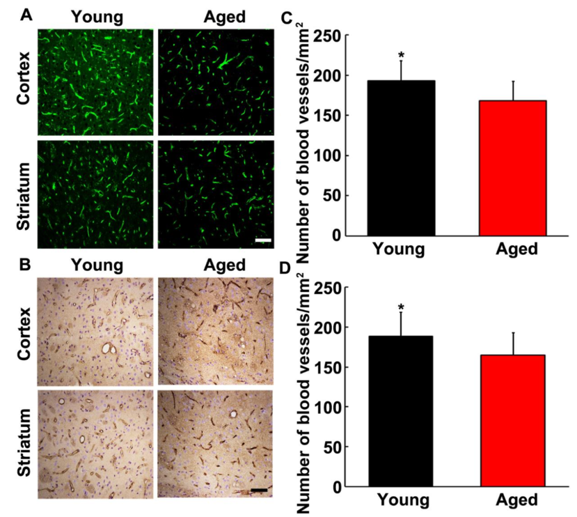The Number Of Blood Vessels In Young Adult And Aged (850x870), Png Download
