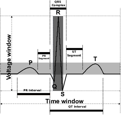Typical Surface Ecg Signal Heart Beat - Heart Rate (393x373), Png Download