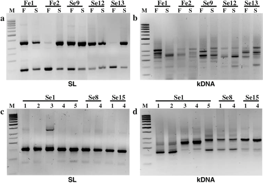 Three Percent Agarose Gel Electrophoretic Analysis (850x597), Png Download