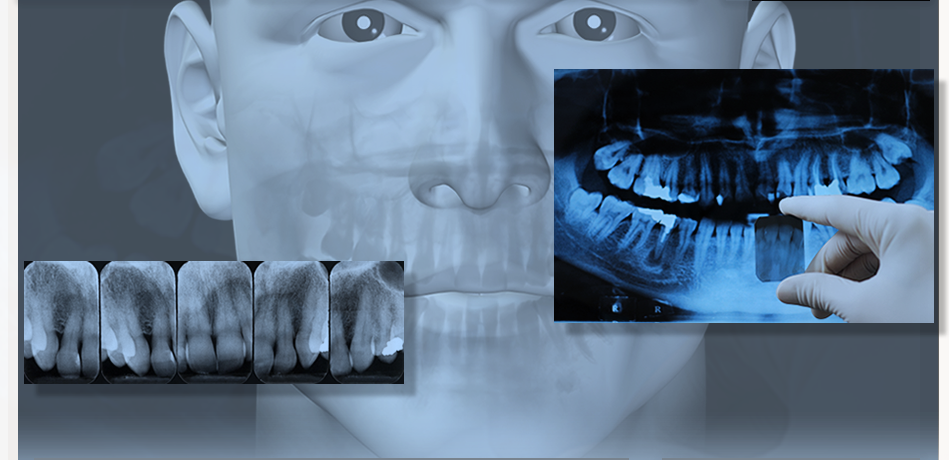 Dental X-ray (951x460), Png Download