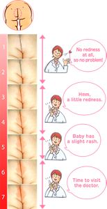 The Degree Of Redness In The Photos May Appear Differently (154x300), Png Download