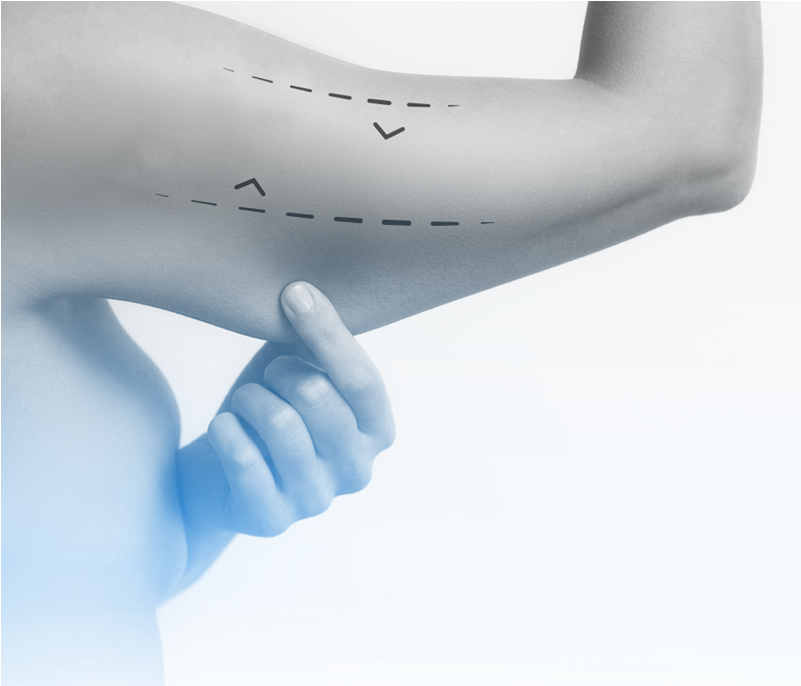 Levantamiento De Brazo (800x1200), Png Download