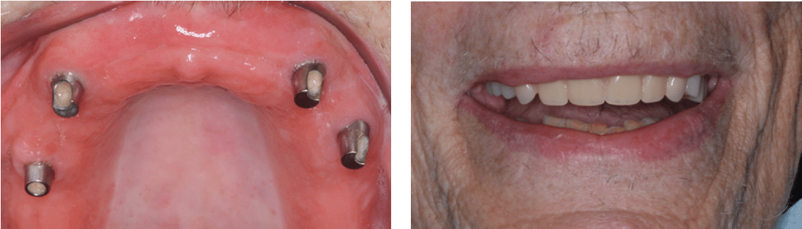 509 York Rd Jenkintown Pa 19046 215 635 (1184x368), Png Download