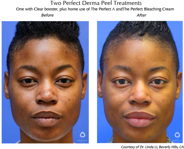 Before & After (646x510), Png Download