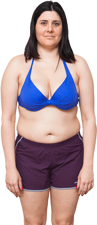 Before And After Png (450x803), Png Download