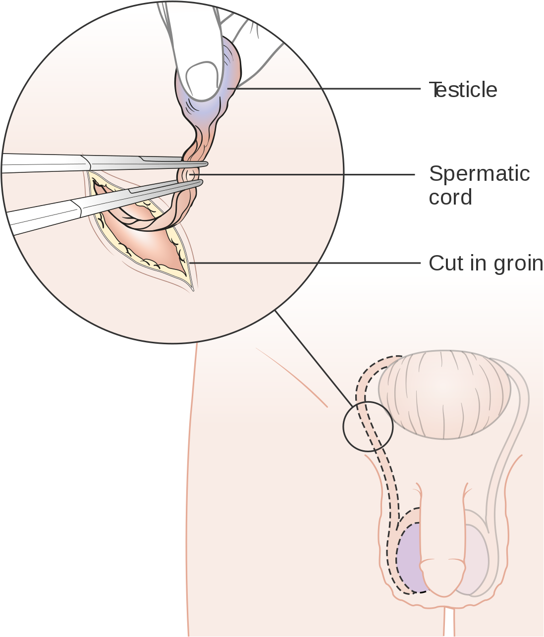 Ballsack Png (1200x1398), Png Download