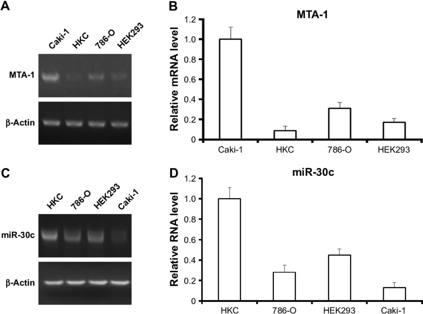 Expression Of Mir 30c Is Inversely Associated With (850x637), Png Download