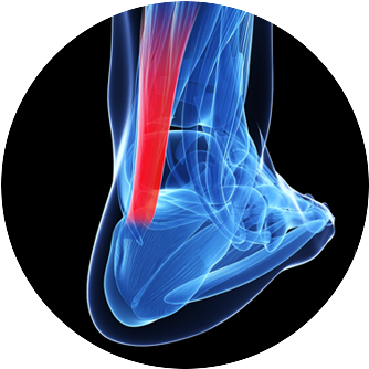 Elute® Fiber Is Driving A Paradigm Shift In Tissue - Entesopatia Do Tendao Calcaneo (347x347), Png Download