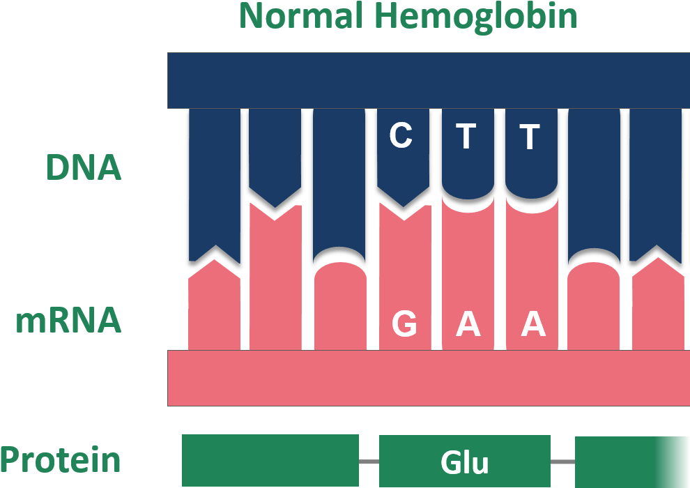 Point Mutation Sickle Cell Normal Hemoglobin (1031x761), Png Download