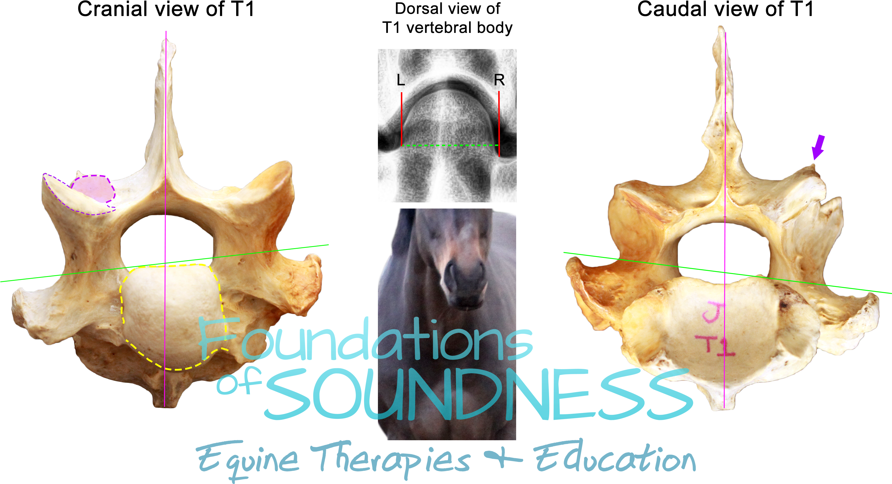 But The Most Interesting Revelation About The Dvl's - Medical Imaging (3600x1800), Png Download