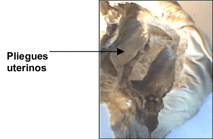 Cápsulas Uterinas Y Membrana Del Huevo O Tercer Membrana - Shell (694x453), Png Download