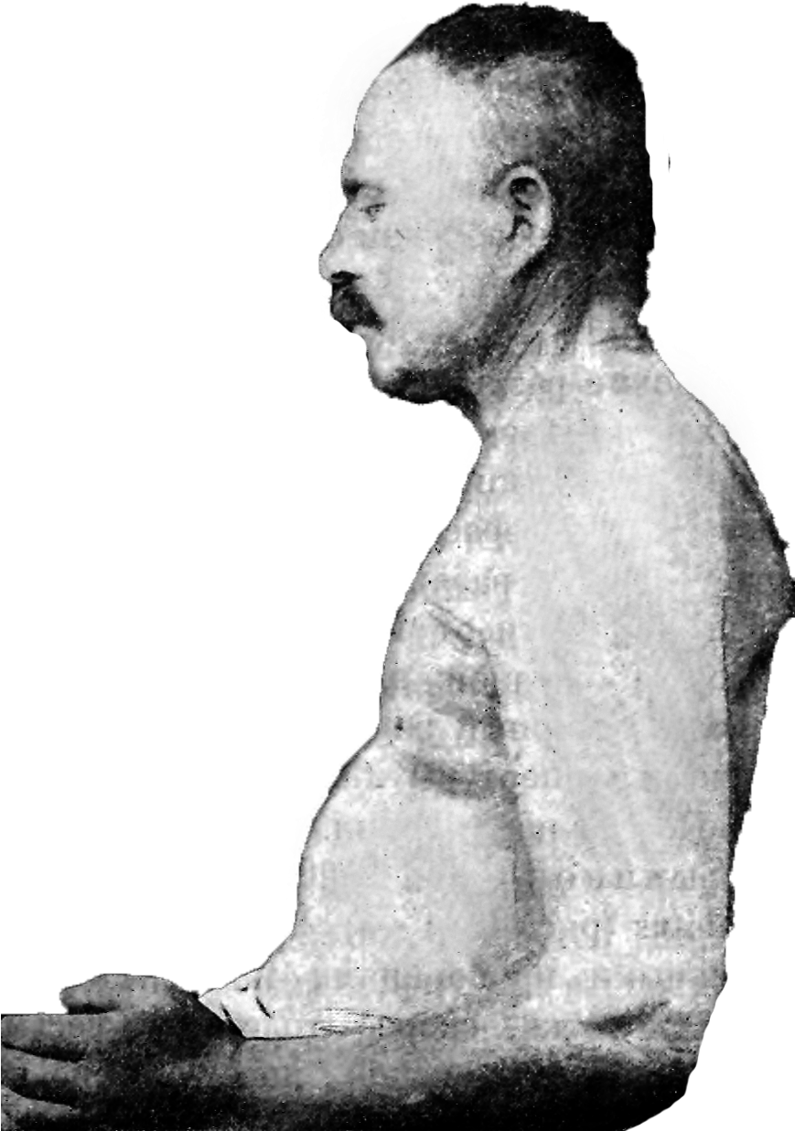 Profile - Human (868x1273), Png Download