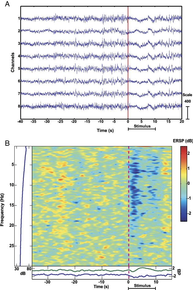Desynchronization Of Eeg In Pigeons Caused By Stimulation - Plot (633x951), Png Download