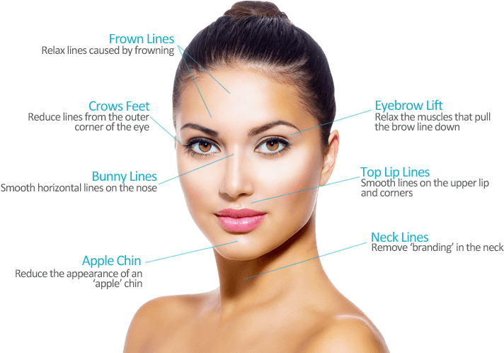 Botox Areas - Facial Aesthetics (800x497), Png Download