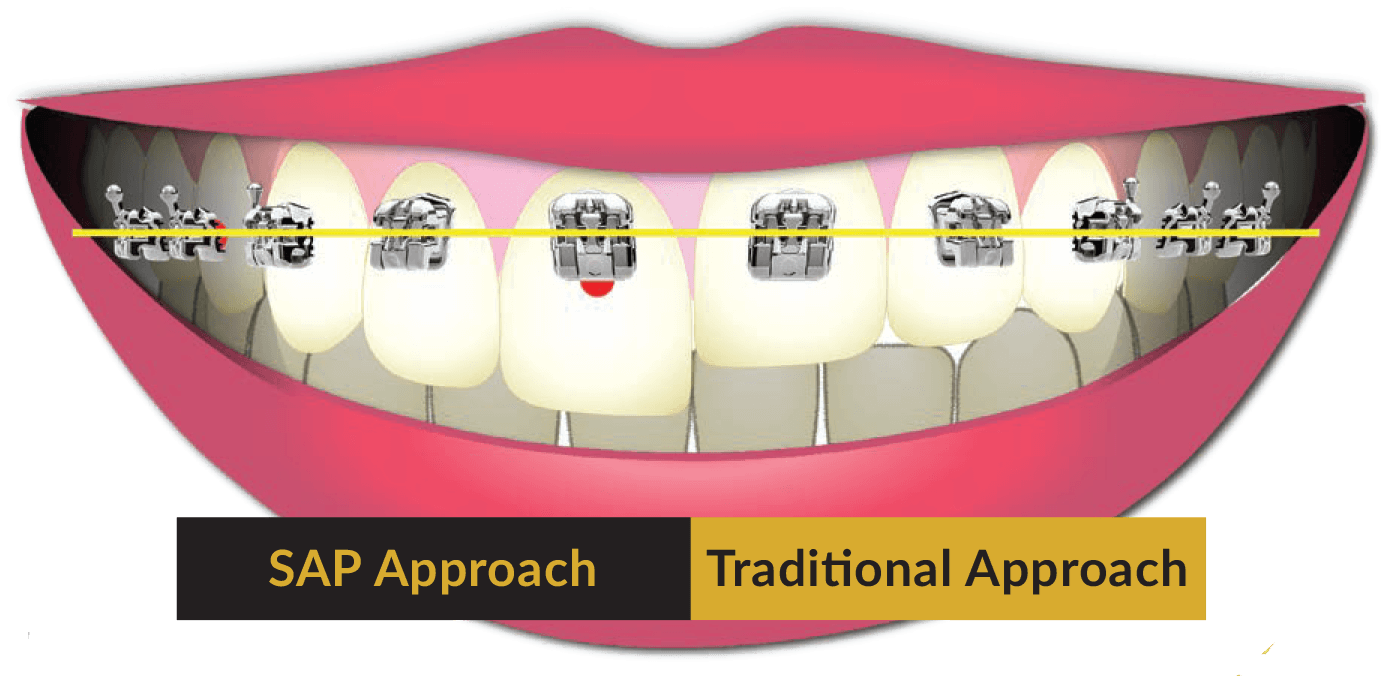 Saoly Benson Utilizes Smile Arc Protection When Treatment - Tongue (1397x702), Png Download