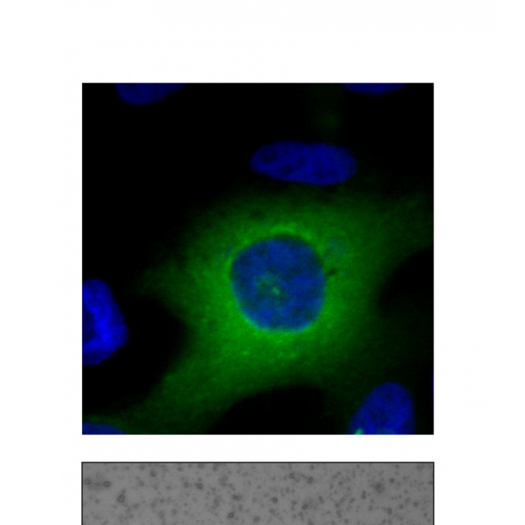 "gotas Líquidas " De Cpeb4en El Citoplasma Celular - Circle (750x750), Png Download