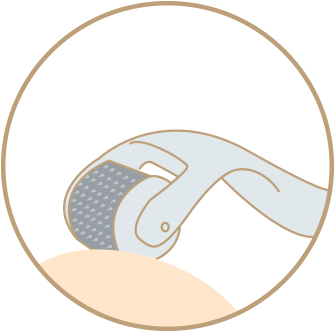 Micro Needling Colour Icon - Hair Transplantation (400x400), Png Download