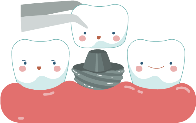 Dental Crowns & Bridges Sudbury Smiles Dentistry Picture - Dental Crown Cartoon (800x480), Png Download