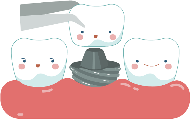 Download Dental Crowns & Bridges Sudbury Smiles Dentistry Picture - Dental Crown Cartoon PNG Image with No Background Download Dental Crowns & Bridges Sudbury Smiles Dentistry Picture - Dental Crown Cartoon PNG Image with No Background