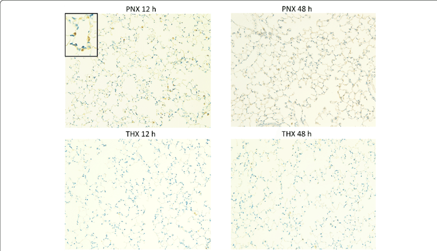 Representative Findings Of Immunohistochemistry For - Number (850x488), Png Download