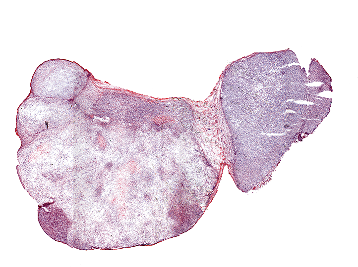 Visualization Of Th-302, A Cancer Therapeutic - Illustration (756x547), Png Download