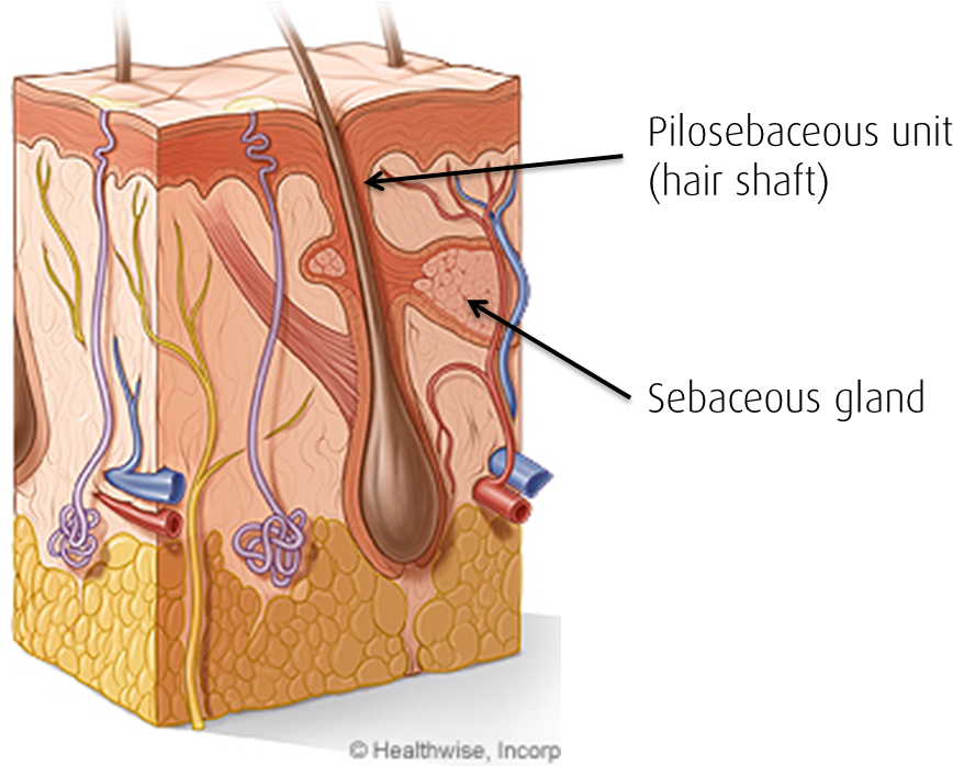 Normal Flow Of Oil From Your Sebaceous Glands To Reach (916x697), Png Download