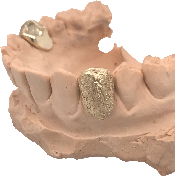 Grillz Sale Event - Carving (570x570), Png Download