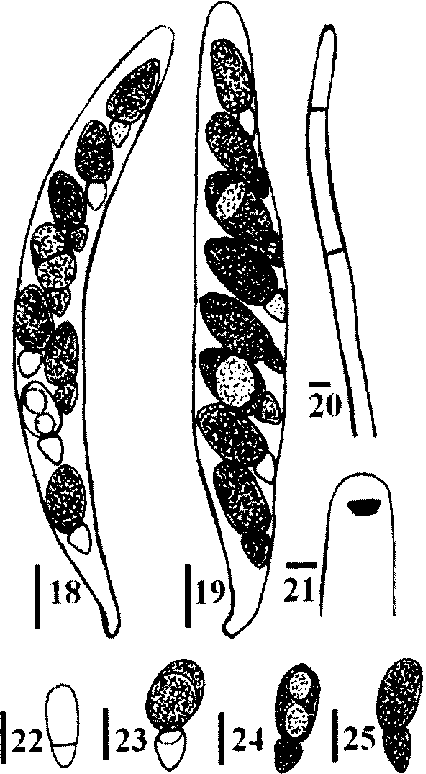 Ascus Apex With A J Subapical Ring - Illustration (426x774), Png Download