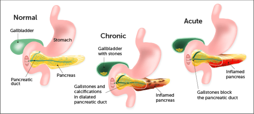 Diagram (850x383), Png Download
