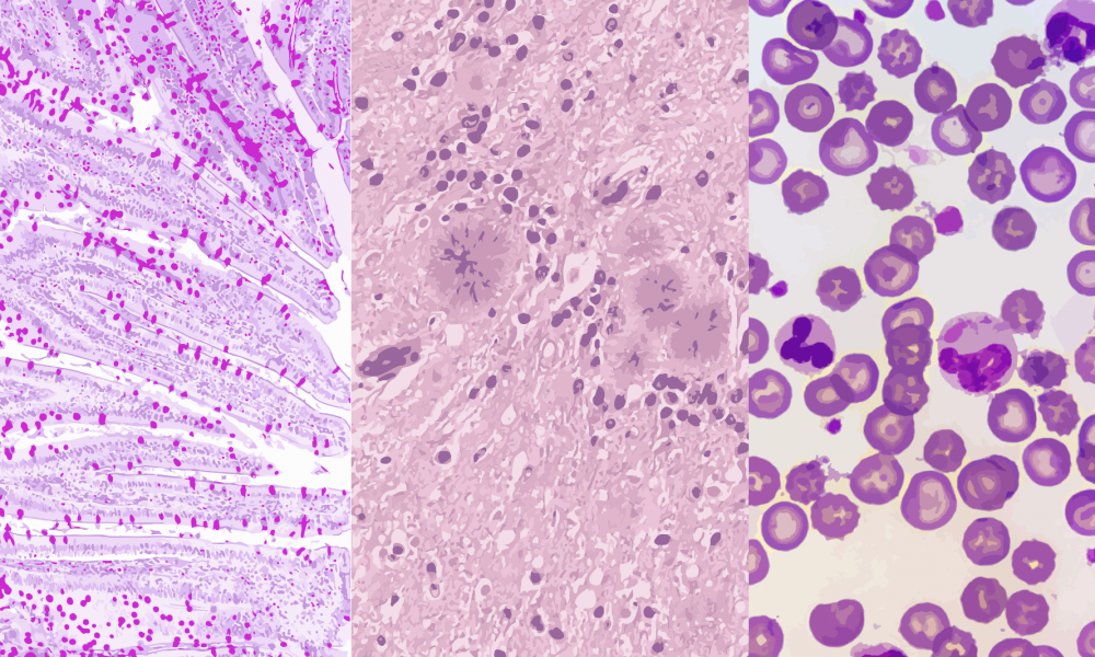 Systems Biology Of Robustness And Homeostatic Mechanisms - Circle (1000x600), Png Download