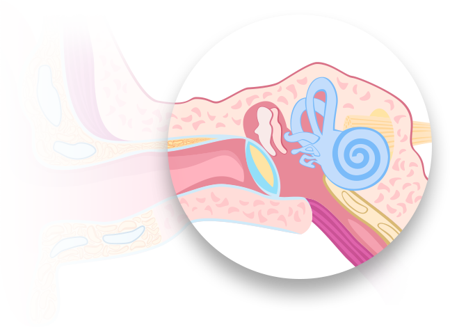 Conductive Hearing Loss - Text (647x470), Png Download