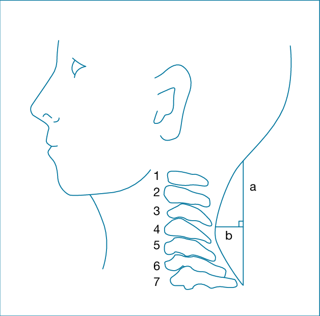 Measurement Of Cervical Curve With Flexible Ruler - Drawing (628x620), Png Download