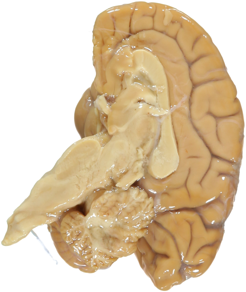 2009-01~processed - Western Gorilla Brain (1000x1187), Png Download