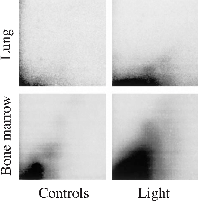 Examples Of Autoradiographic Patterns Of Dna Adducts - Monochrome (675x687), Png Download