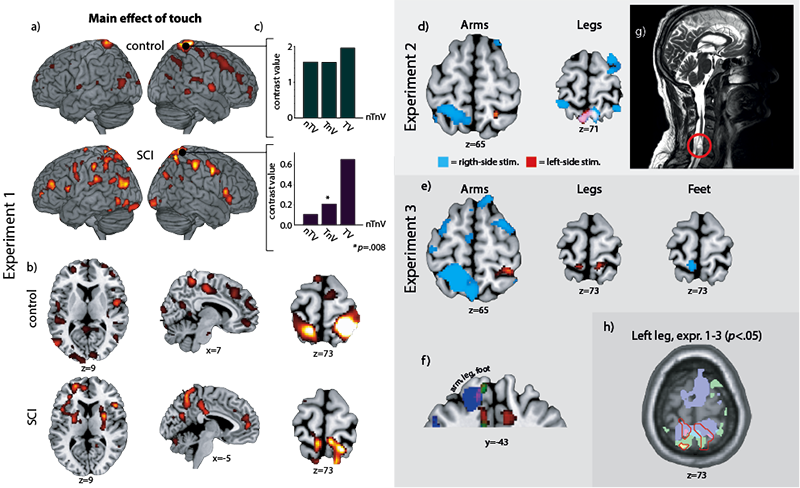 Both The Healthy Control And The Spinal Cord Injury - Illustration (800x488), Png Download