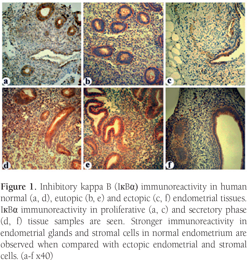 Inhibitory Kappa B Immunoreactivity In Human Normal - Visual Arts (1062x1115), Png Download