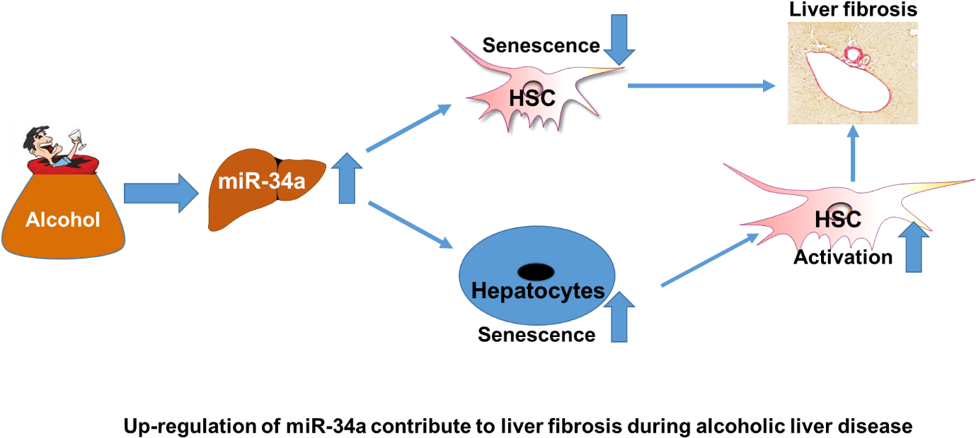 “understanding The Mechanisms Underlying Hsc Activation - Senescence Liver (1401x653), Png Download