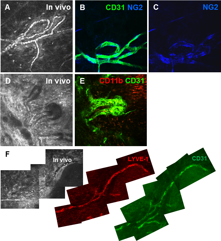 Figure 21 - - Cd31 Cornea (746x792), Png Download